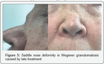 Click here to view Large Figure 5