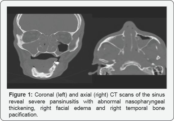 Click here to view Large Figure 1
