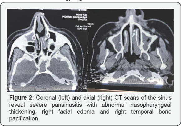 Click here to view Large Figure 2