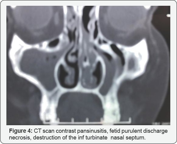 Click here to view Large Figure 4