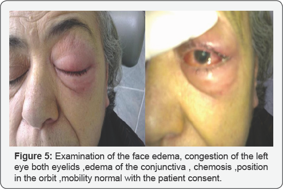 Click here to view Large Figure 5