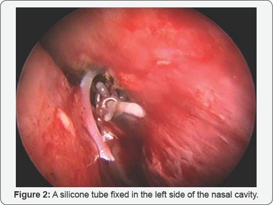 Click here to view Large figure 1