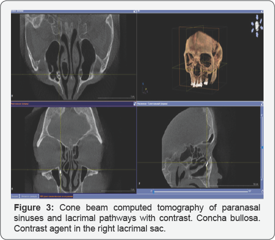 Click here to view Large figure 1