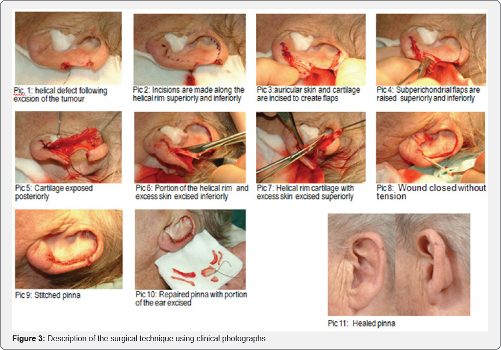 Click here to view Large Figure 3