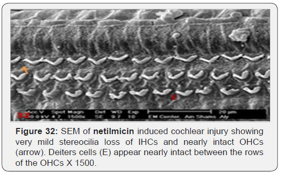 Click here to view Large Figure 32