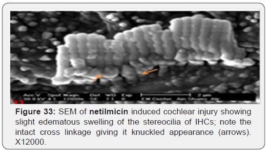 Click here to view Large Figure 33