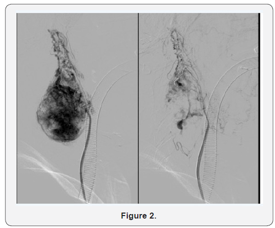Click here to view Large Figure 2
