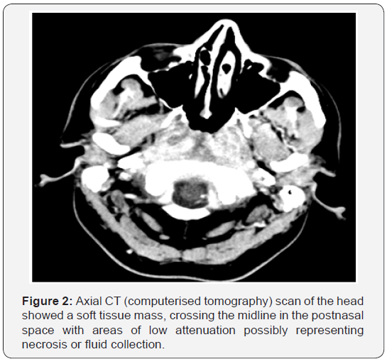 Click here to view Large Figure 2