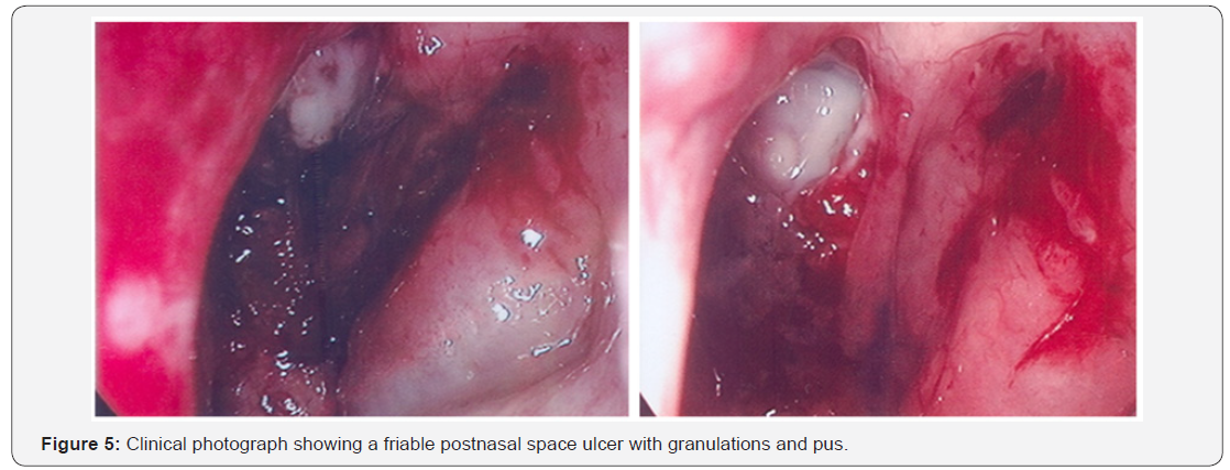 Click here to view Large Figure 5