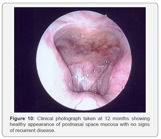 Click here to view Large Figure 10
