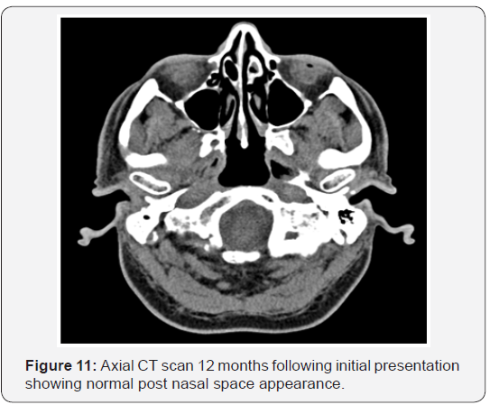 Click here to view Large Figure 11