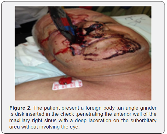 Click here to view Large Figure 2