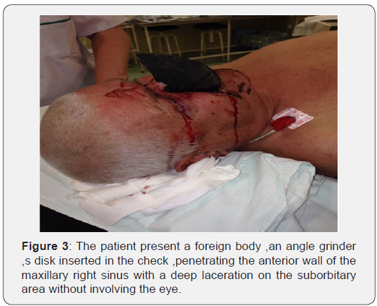 Click here to view Large Figure 3