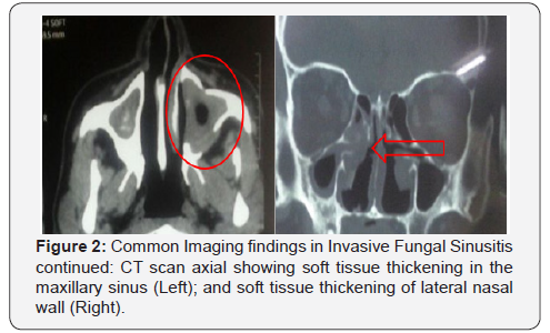 Click here to view Large Figure 2