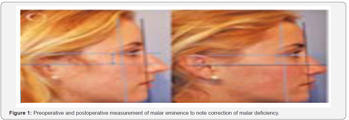 Click here to view Large Figure 1