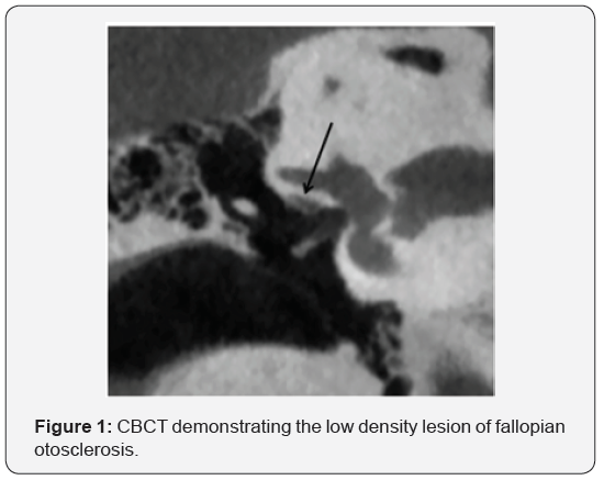Click here to view Large Figure 1