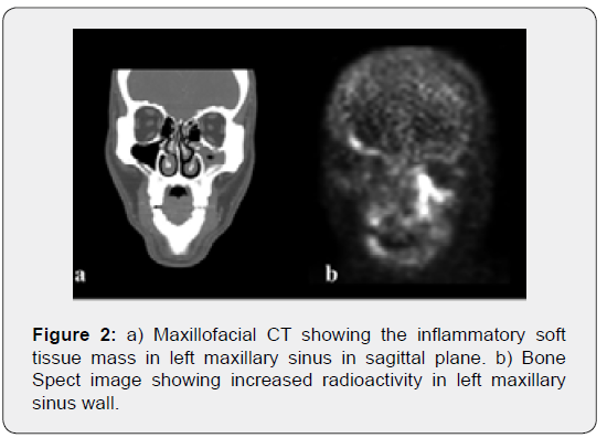 Click here to view Large Figure 2