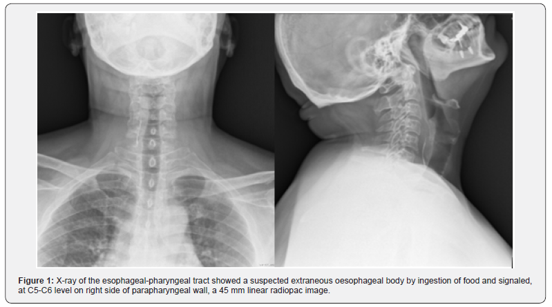 Click here to view Large Figure 1