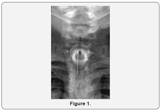 Click here to view Large Figure 1