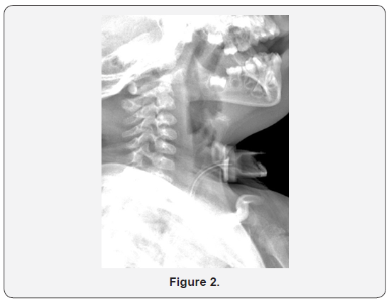 Click here to view Large Figure 2