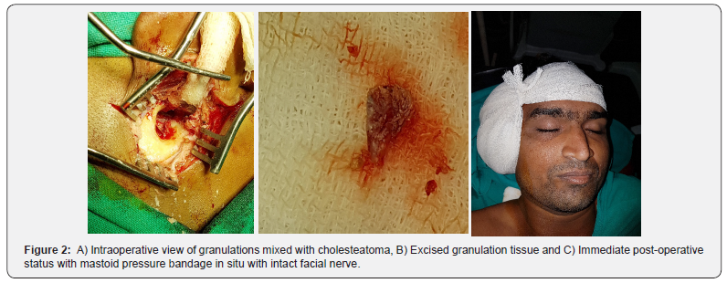 Click here to view Large Figure 2