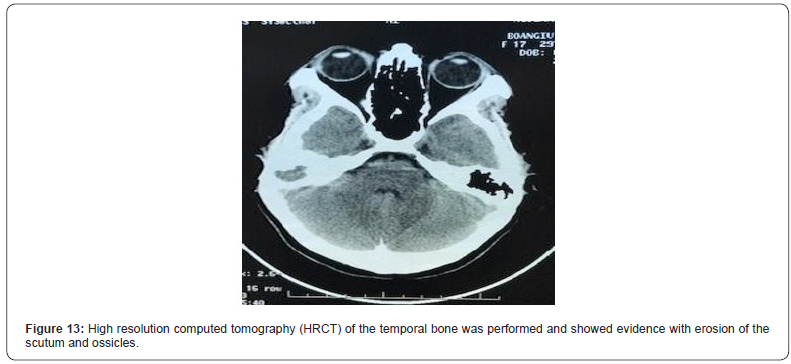 Click here to view Large Figure 13