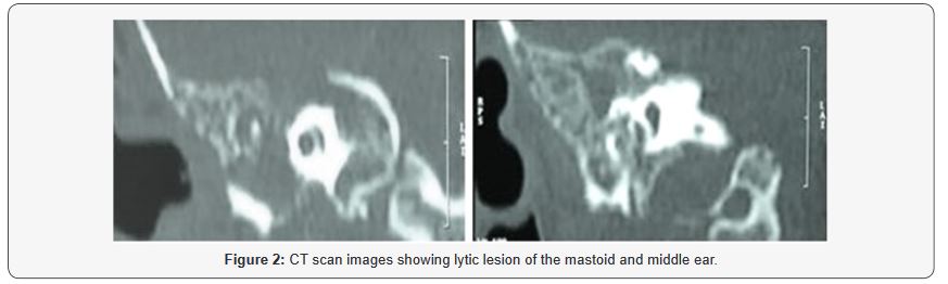 Click here to view Large Figure 2