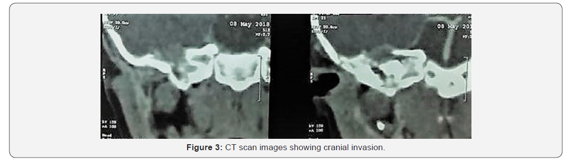 Click here to view Large Figure 3