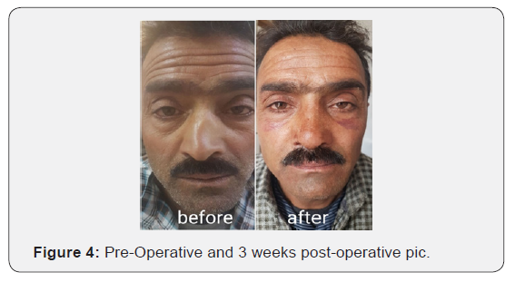 Click here to view Large Figure 4