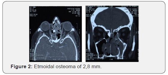 Click here to view Large Figure 2