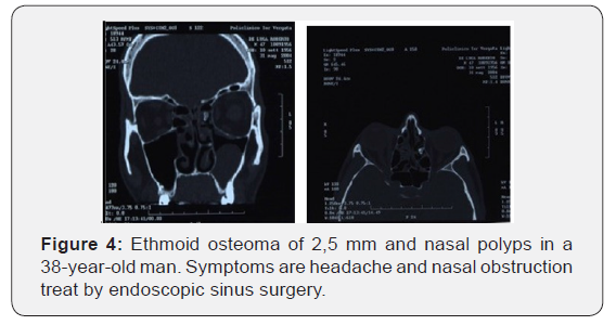 Click here to view Large Figure 4