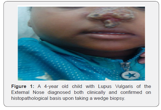 Click here to view Large Figure 1