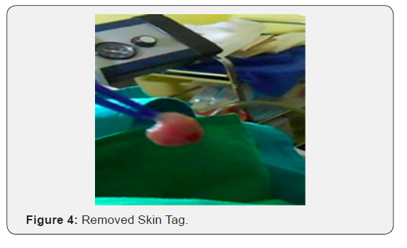 Click here to view Large Figure 4