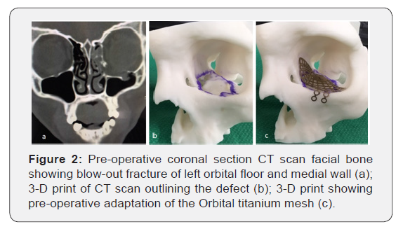 Click here to view Large Figure 2