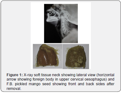 Click here to view Large Figure 1