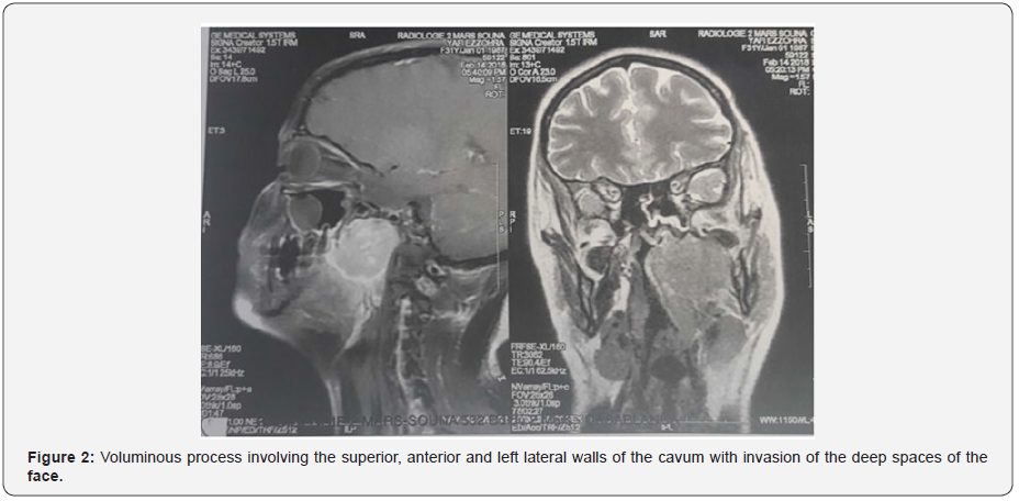 Click here to view Large Figure 2 Material Science