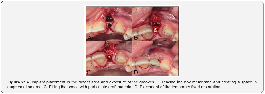Click here to view Large Figure 2 Material Science