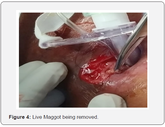 Click here to view Large Figure 4