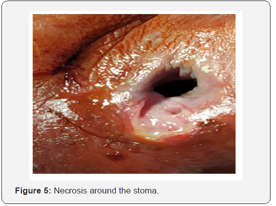 Click here to view Large Figure 5