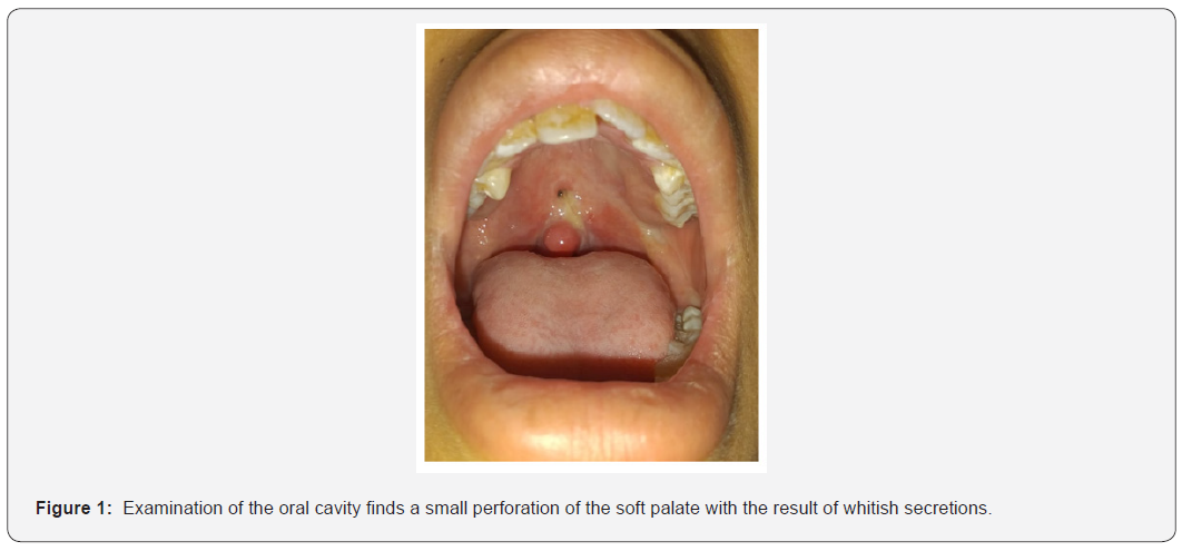 Click here to view Large Figure 1 Global Journal of Otolaryngology