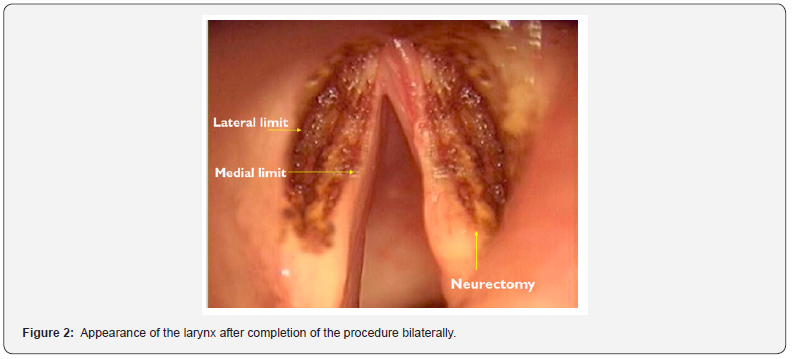 Click here to view Large Figure 2 Global Journal of Otolaryngology