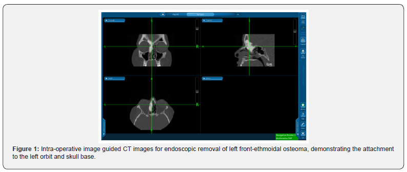 Click here to view Large Figure 1