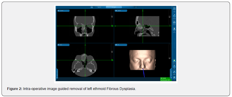 Click here to view Large Figure 2