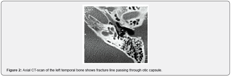 Click here to view Large Figure 2