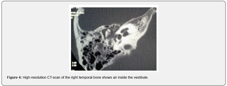 Click here to view Large Figure 4