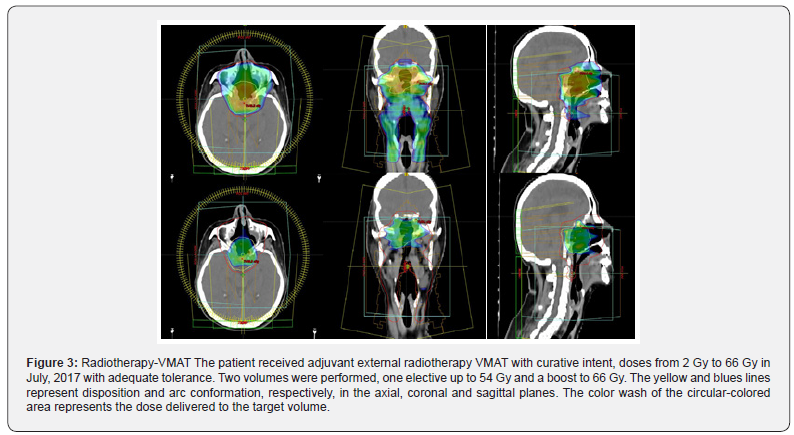 Click here to view Large Figure 3
