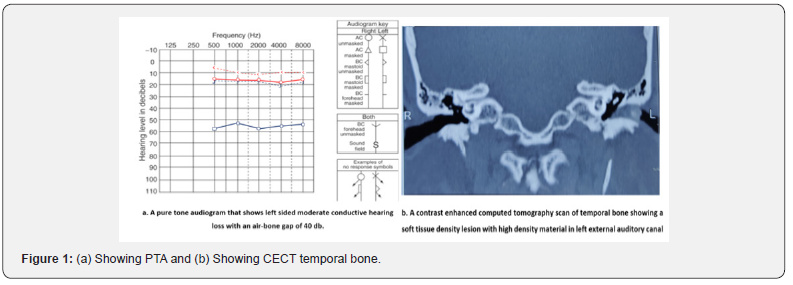 Click here to view Large Figure 1
