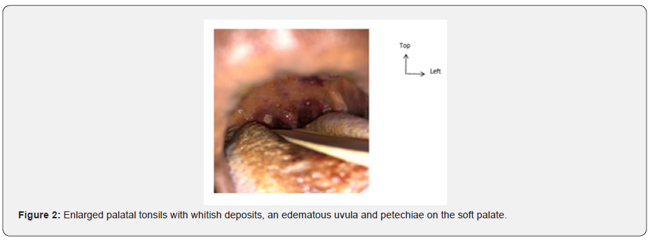 Click here to view Large Figure 2