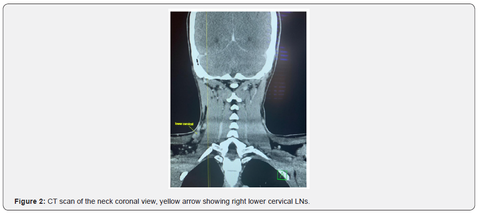Click here to view Large Figure