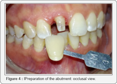 Click here to view Large Figure 4